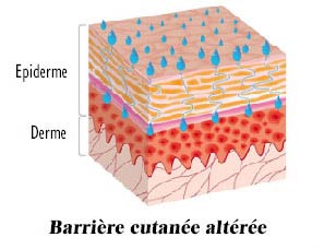 Ceramides altered